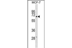 Western blot analysis in MCF-7 cell line lysates (35ug/lane). (gGT6 Antikörper  (N-Term))