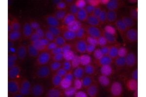 Immunofluorescence staining of methanol-fixed MCF cells using Phospho-ESR1-S106 antibody. (Estrogen Receptor alpha Antikörper  (pSer106))