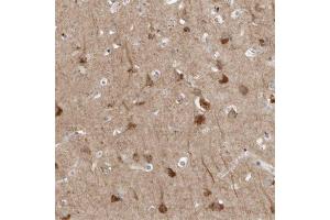 Immunohistochemical staining of human cerebral cortex with TNFRSF11A polyclonal antibody  shows strong cytoplasmic positivity in neurons at 1:500-1:1000 dilution. (TNFRSF11A Antikörper)