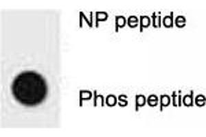 Dot blot analysis of p-ERBB2 antibody. (ErbB2/Her2 Antikörper  (pTyr1196))