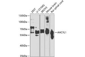 Western blot analysis of extracts of various cell lines, using  antibody (ABIN6129886, ABIN6136667, ABIN6136668 and ABIN6223725) at 1:1000 dilution. (AHCYL1 Antikörper  (AA 31-260))