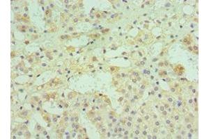 Immunohistochemistry (IHC) image for anti-Dipeptidyl-Peptidase 7 (DPP7) (AA 190-410) antibody (ABIN7149982)