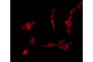 ABIN6277157 staining HuvEc cells by IF/ICC. (KRT17 Antikörper  (C-Term))