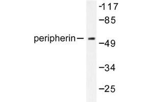 Image no. 1 for anti-Peripherin (PRPH) antibody (ABIN271783) (Peripherin Antikörper)