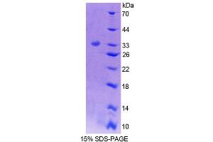 SDS-PAGE (SDS) image for Protein tyrosine Phosphatase, Non-Receptor Type 5 (Striatum-Enriched) (PTPN5) (AA 270-533) protein (His tag) (ABIN4989866) (PTPN5 Protein (AA 270-533) (His tag))