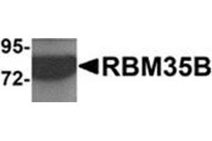 Western blot analysis of RBM35B in human lung tissue lysate with RBM35B antibody at 1 μg/ml. (ESRP2 Antikörper  (C-Term))