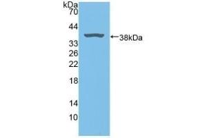Detection of Recombinant BLVRA, Rat using Polyclonal Antibody to Biliverdin Reductase A (BLVRA) (Biliverdin Reductase Antikörper  (AA 10-279))