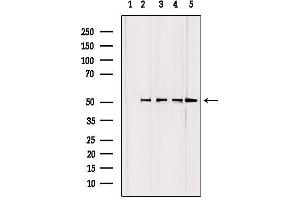 Western blot analysis of extracts from various samples, using GCSc-γ Antibody. (GCLC Antikörper  (N-Term))