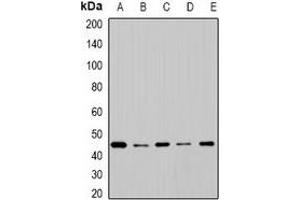 Western blot analysis of Cytochrome P450 2F1 expression in SW620 (A), BT474 (B), mouse lung (C), mouse liver (D), rat brain (E) whole cell lysates.