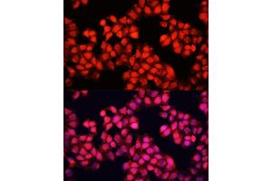 Immunofluorescence analysis of HeLa cells using ALAD antibody (ABIN6129891, ABIN6136749, ABIN6136751 and ABIN6216012) at dilution of 1:100.