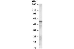 Western blot testing of human lung lysate with RNF8 antibody at 0. (RNF8 Antikörper)