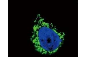 Immunofluorescence (IF) image for anti-Insulin-Like Growth Factor Binding Protein 2, 36kDa (IGFBP2) (AA 277-305) antibody (ABIN3031351)