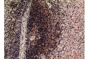 Immunohistochemistry (IHC) image for anti-Leukocyte Immunoglobulin-Like Receptor, Subfamily B (With TM and ITIM Domains), Member 5 (LILRB5) (Internal Region) antibody (ABIN6287603)
