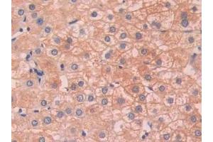 Detection of SAP in Human Liver Tissue using Polyclonal Antibody to Serum Amyloid P Component (SAP) (APCS Antikörper  (AA 23-223))