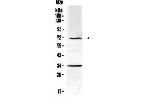 Western blot analysis of Alpha 1 Fetoprotein using anti-Alpha 1 Fetoprotein antibody . (alpha Fetoprotein Antikörper  (AA 19-254))