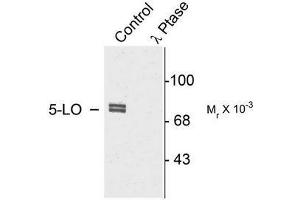 Image no. 1 for anti-Arachidonate 5-Lipoxygenase (ALOX5) (pSer523) antibody (ABIN372586) (ALOX5 Antikörper  (pSer523))