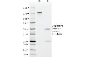 SDS-PAGE Analysis Purified EBV Mouse Monoclonal Antibody (1108-1). (EBV EA Antikörper)