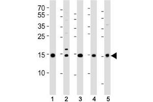 Western blot analysis of lysate from (1) 293T, (2) HeLa, (3) HL-60, (4) Jurkat cell lines and (5) rat liver tissue using SUMO2/3 antibody at 1:1000. (SUMO2/3 Antikörper  (AA 49-81))