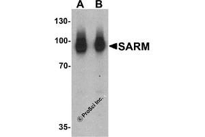 Western Blotting (WB) image for anti-Sterile alpha and TIR Motif Containing 1 (SARM1) (N-Term) antibody (ABIN1031550) (SARM1 Antikörper  (N-Term))