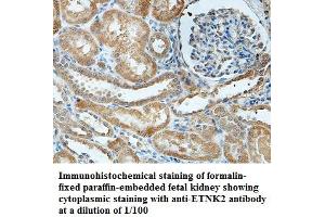 Image no. 1 for anti-Ethanolamine Kinase 2 (ETNK2) antibody (ABIN1576385) (Ethanolamine Kinase 2 Antikörper)
