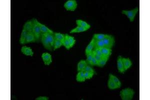 Immunofluorescence staining of HepG2 cells with ABIN7151530 at 1:166, counter-stained with DAPI. (ELMOD3 Antikörper  (AA 1-102))