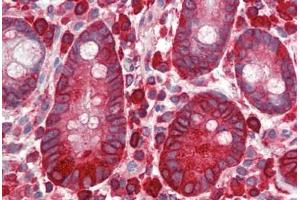 Human Small Intestine (formalin-fixed, paraffin-embedded) stained with EEF2 antibody ABIN334266 at 1:100 followed by biotinylated goat anti-rabbit IgG secondary antibody ABIN481713, alkaline phosphatase-streptavidin and chromogen. (EEF2 Antikörper  (pThr56))