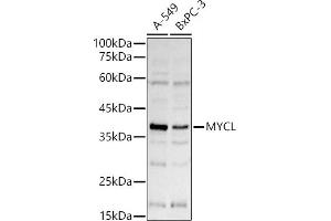 Western blot analysis of extracts of various cell lines, using MYCL antibody (ABIN7269669) at 1:1000 dilution. (LMYC Antikörper  (AA 40-180))