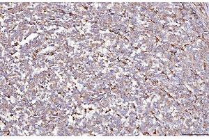 IHC analysis of DAB2 using anti-DAB2 antibody (ABIN7602613). (DAB2 Antikörper  (AA 89-770))