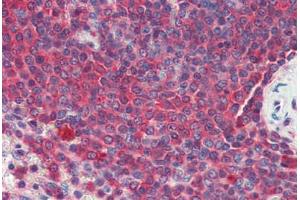 Human Spleen (formalin-fixed, paraffin-embedded) stained with Heat Shock Protein 90 (HSP90) antibody ABIN462104 at 10 ug/ml followed by biotinylated secondary antibody, alkaline phosphatase-streptavidin and chromogen.