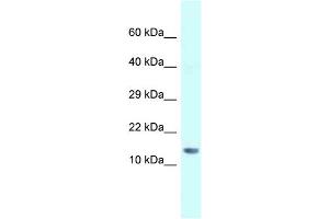 WB Suggested Anti-Gm14277 Antibody   Titration: 1. (Gm14277 Antikörper  (N-Term))