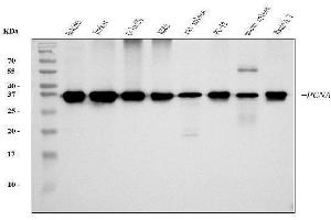 Western blot analysis of PCNA using anti-PCNA antibody (ABIN7599181).