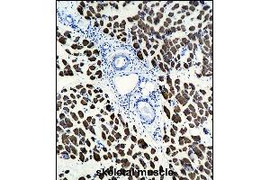 ACTA1 Antibody (ABIN1536597 and ABIN2843809) immunohistochemistry analysis in formalin fixed and paraffin embedded human skeletal muscle followed by peroxidase conjμgation of the secondary antibody and DAB staining. (Actin Antikörper)