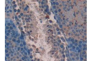DAB staining on IHC-P; Samples: Mouse Testis Tissue (AATK Antikörper  (AA 137-386))