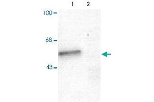 Western blot of mouse forebrain lysates from Wild Type (Control, lane 1) and Gabra1 knockout (Gabra1-K/O, lane 2) animals showing specific immunolabeling of the ~51 alpha1-subunit of the Gabra1.