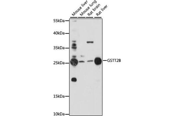 GSTT2B anticorps  (AA 115-244)