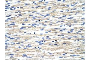 CBX6 antibody was used for immunohistochemistry at a concentration of 4-8 ug/ml to stain Skeletal muscle cells (arrows) in Human Muscle. (CBX6 Antikörper  (N-Term))