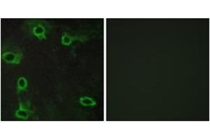 Immunofluorescence analysis of COS7 cells, using ADORA2A Antibody. (Adenosine A2a Receptor Antikörper  (AA 120-169))