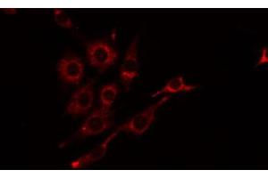 ABIN6274815 staining Hela by IF/ICC. (BST1 Antikörper  (Internal Region))