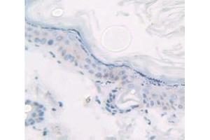 IHC-P analysis of Kidney tissue, with DAB staining. (KRT14 Antikörper  (AA 122-429))