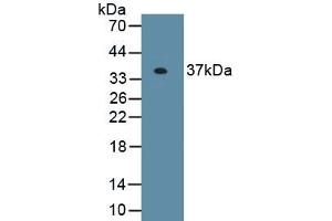 Detection of Recombinant EXOSC2, Human using Polyclonal Antibody to Exosome Component 2 (EXOSC2) (EXOSC2 Antikörper  (AA 1-293))