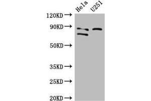Western Blot Positive WB detected in: Hela whole cell lysate, U251 whole cell lysate All lanes: FCHO2 antibody at 3 μg/mL Secondary Goat polyclonal to rabbit IgG at 1/50000 dilution Predicted band size: 89, 44, 86 kDa Observed band size: 89, 86 kDa (FCHO2 Antikörper  (AA 100-203))