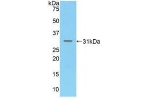 Detection of Recombinant MAdCAM1, Mouse using Polyclonal Antibody to Mucosal Addressin Cell Adhesion Molecule 1 (MAdCAM1) (MADCAM1 Antikörper  (AA 29-297))