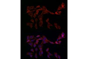 Immunofluorescence analysis of PC-12 cells using OP antibody (ABIN6129426, ABIN6145031, ABIN6145032 and ABIN6225150) at dilution of 1:100 (40x lens). (OPA1 Antikörper  (AA 661-960))