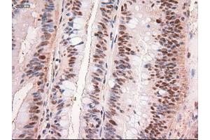 Image no. 1 for anti-Myc Proto-Oncogene protein (MYC) antibody (ABIN1497012) (c-MYC Antikörper)