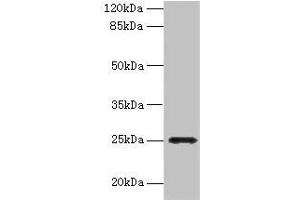 Western blot All lanes: FGFBP2 antibody at 2 μg/mL + Human serum Secondary Goat polyclonal to rabbit IgG at 1/10000 dilution Predicted band size: 25 kDa Observed band size: 25 kDa (FGFBP2 Antikörper  (AA 20-223))