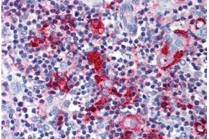 Anti-CCR9 antibody  ABIN1048406 IHC staining of human thymus.