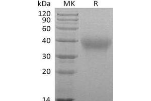 Western Blotting (WB) image for Hepatitis A Virus Cellular Receptor 2 (TIM 3) protein (His tag) (ABIN7320991)