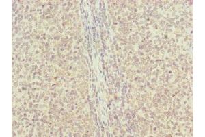 Immunohistochemistry of paraffin-embedded human tonsil tissue using ABIN7151143 at dilution of 1:100 (RNF13 Antikörper  (AA 204-381))