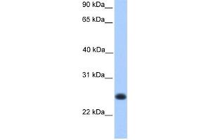 WB Suggested Anti-C12orf68 Antibody Titration: 0.