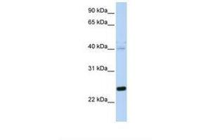 Image no. 1 for anti-Heat Shock 22kDa Protein 8 (HSPB8) (N-Term) antibody (ABIN6739048) (HSPB8 Antikörper  (N-Term))
